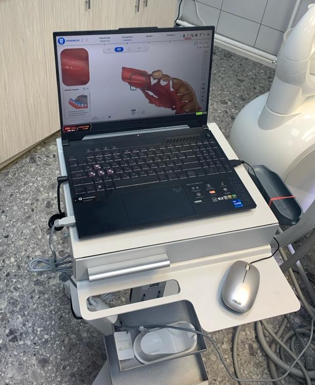 Сканирование стоматологическим сканером