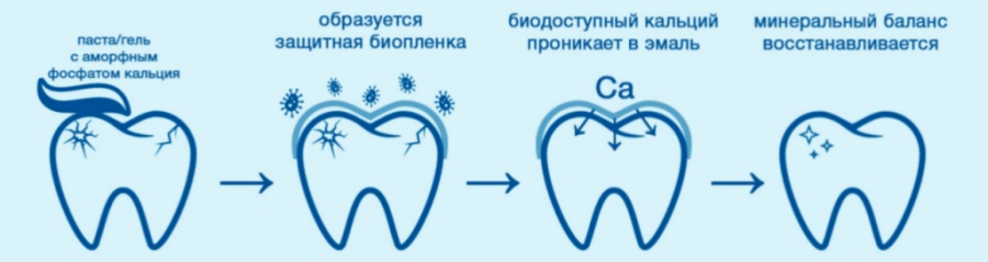Отбеливание зубов в Кирове